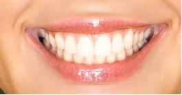 Pearl Smile Dental in Milpitas CA